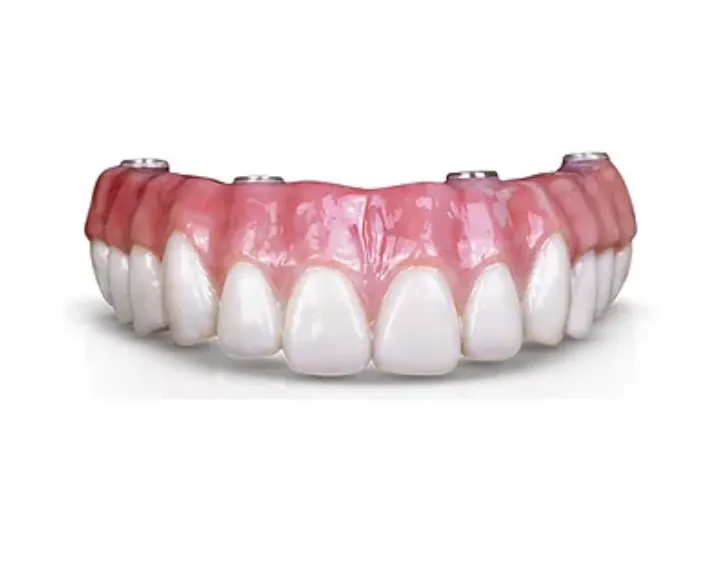 Teeth Extraction & Temporary Prosthetics